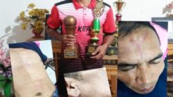 Diduga Dikeroyok Saat Melatih Sepak Bola Anak SD, Pelatih Usia Dini di Desa Pendung Hilir Laporkan Kasus ke Polisi